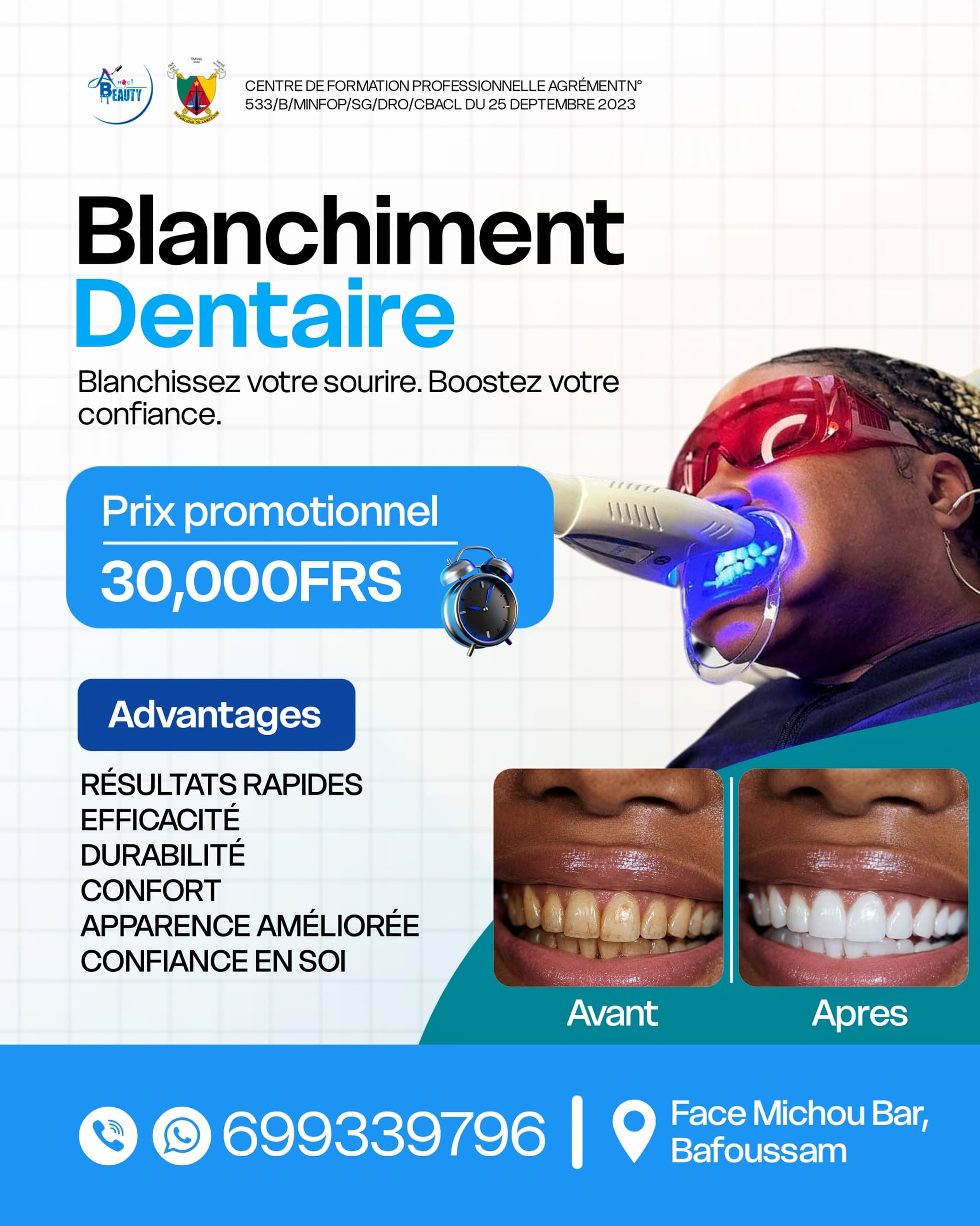 Esthétique - Blanchiment Dentaire